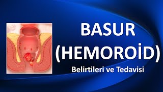 BASUR HEMOROİD NEDİR Belirtileri ve Tedavisi [upl. by Lema]