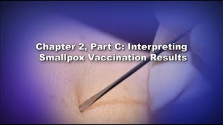 Chapter 2 Part C Interpreting Smallpox Vaccination Results [upl. by Skye]