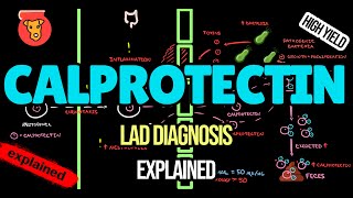 CALPROTECTIN Clinical significance Lab values Intestinal Inflammation [upl. by Atnahsal]