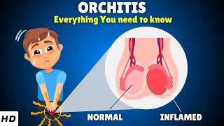 Orchitis – Types Causes Signs and Symptoms Diagnosis amp Treatment [upl. by Lombard]