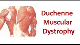 Duchenne Muscular Dystrophy [upl. by Madaras180]