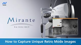 How to Capture Unique Retro Mode Images  NIDEK Mirante SLOOCT [upl. by Siravat681]