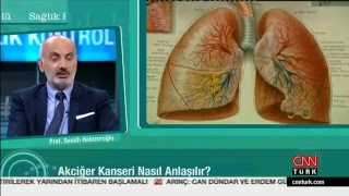 Akciğer Kanseri Cerrahi Tedavisi  CNN Turk [upl. by Idnerb]