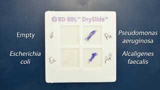 Demo Biochemical Tests  Oxidase Test [upl. by Stclair267]