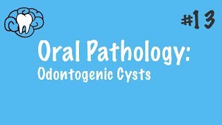 Oral Pathology  Odontogenic Cysts  INBDE ADAT [upl. by Dyer667]