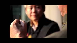 Acupuncture and moxibustion of traditional Chinese medicine [upl. by Thirza]