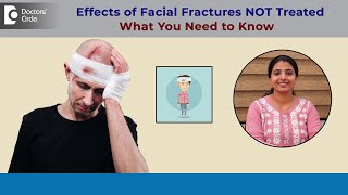 7 Complications of Untreated Fractures of Face  Fracture Malunion DrShama Mohan Doctors Circle [upl. by Pontius813]