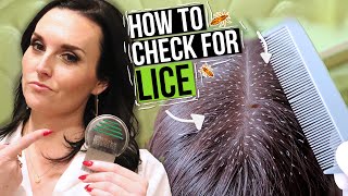 How to Check for Lice  5 Lice Treatment Tips from a Professional [upl. by Eclud]