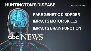 Living with Huntington’s disease [upl. by Beret]