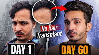 How I Reversed My Hair Loss Kaash yeh pehele pata hota 😔 [upl. by Dupuy]