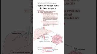 Sedative  hypnotics in liver surgery [upl. by Elledoj]