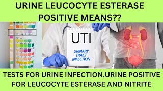 URINE EXAMINATION LEUCOCYTE ESTERASE POSITIVE UTI URINARY NITRITE AND LEUCOCYTE ESTERASE POSITIVE [upl. by Tore]