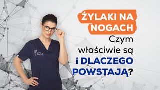 Żylaki na nogach – co musisz o nich wiedzieć 🦵 [upl. by Notloc292]