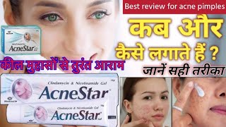 Acnestar gel for acne pimples कील मुंहासों से तुरंत आराम असरदार दवाई youtubeviralvideo ytvideo [upl. by Ati]