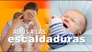 Las escaldaduras en los bebés  síntomas causas y soluciones [upl. by Anaihs856]