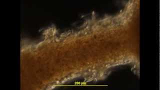 Observation of the ciliate Trichodina pediculus quotcleaningquot a brown Hydrawmv [upl. by Ladnik789]