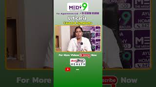 Urticaria Causes amp Symptoms in Telugu  skinallergies skinrashes urticaria homeopathy ytshorts [upl. by Werdnael489]