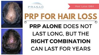 Monthly PRP Hair Loss Injections Have Limited Results  Combo Treatment Lasts Years with 1 Treatment [upl. by Ackley739]