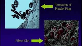 Part 2  Everything You Wanted to Know About Blood Clots  Stop the Clot Forum [upl. by Annatnas980]