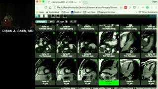 Stress MRI Methodology Current Role and Case Studies Dipan Shah MD December 13 2016 [upl. by Jandel300]