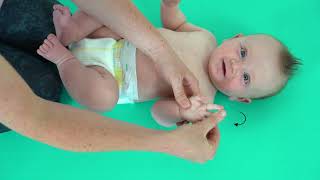 Baby Development  Erbs Palsy  Hand Massage [upl. by Cutlerr]