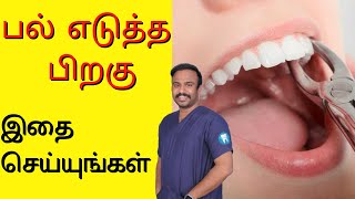 பல் எடுத்த பிறகு இதைச் செய்யுங்கள்  What to do After Tooth Removal  Tamil [upl. by Frantz]