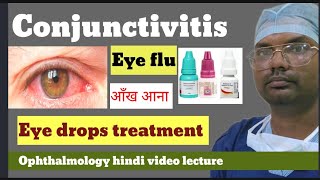 conjunctivitis  eye flu  conjunctivitis treatment  conjunctivitis eye drops  conjunctivitis [upl. by Hellene]