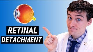 Retinal Detachment Symptoms and Treatment  How Retinal Detachment is Treated [upl. by Aerdnak]