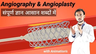 जानिए Angiography amp Angioplasty kya hai or kaise hoti hai  Angiography test procedure  angioplasty [upl. by Darcy]