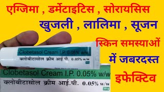 Clobetasol Cream IP Uses in Hindi  क्लोबिटासोल क्रीम के उपयोग [upl. by Cox801]