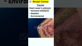 Breast cancer symptoms  breast cancer ke lakshan  breast cancer kaise hota hai [upl. by Wes]