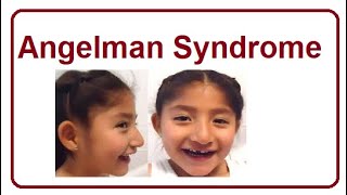 Angelman Syndrome  Key Facts amp Symptoms  2024 [upl. by Irollam]