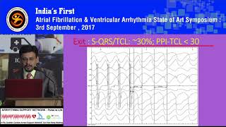 Ventricular Tachycardia Substrate in Structural Heart Disease  VT Ablation [upl. by Maurene950]