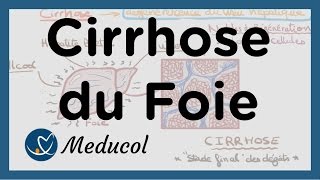 Cirrhose du foie symptômes et fibrose du foie [upl. by Arhsub]