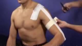 AC acromioclavicular Joint Taping Technique [upl. by Anastasie918]