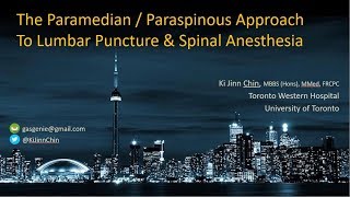 Paraspinous  Paramedian Approach to Lumbar Puncture  Spinal Anesthesia [upl. by Agem]