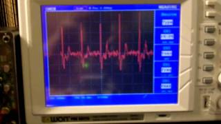 Arduino ECG EKG Heart rate monitor circuit prototype [upl. by Cirdet]