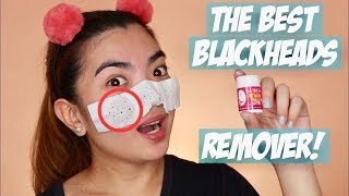 BEST BLACKHEADS REMOVER [upl. by Dinerman446]