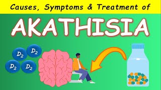 Akathisia by Antipsychotics  Causes Symptoms and Treatments [upl. by Nikolia]