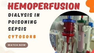 What is Hemoperfusion  Dialysis in Poisoning  Dialysis in sepsis  cytosorb [upl. by Catton]