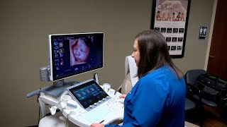 MaternalFetal Ultrasound Careers  Community Health Network LONG [upl. by Nilyarg251]