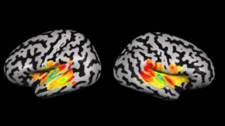 Spread of best frequency brain areas according to auditory stimulus [upl. by Ocsecnarf189]