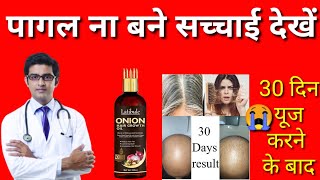 Latibule black seed onion hair oil uses benefits latibule black seed onion hair oil [upl. by Mort]