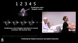 How to Perform Valsalva Maneuver in Patients with HCM [upl. by Ahsinroc801]