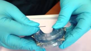 How to Adjust Your Herbst Oral Appliance [upl. by Nomis]