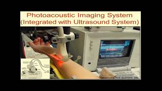 Photoacoustic Imaging [upl. by Bevers]