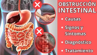 OBSTRUCCIÓN INTESTINAL  Causas signos y síntomas diagnóstico y tratamiento [upl. by Yreved559]