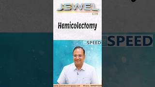 Hemicolectomy by DrKVinayak Senthil neetss iniss medico neetpg [upl. by Albright477]