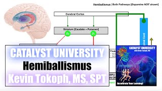 Hemiballismus  Pathogenesis SignsSymptoms and Detailed Mechanism [upl. by Drapehs]