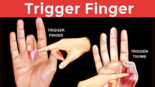 Trigger finger in Urdu Hindi Causes Symptoms and Physiotherapy treatment and Exercise [upl. by Alliuqet]